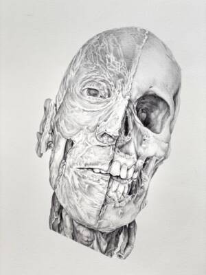 Head 4, Prosected Head, Muscle, Skull View by Sonya G Peters